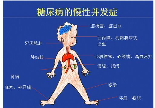 小分子肽有降血糖的作用吗？为什么血糖人群忽高忽低，其时原因就是在这里(图1)